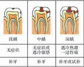 深齲的症狀