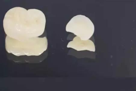 不同的嵌體(ti) 