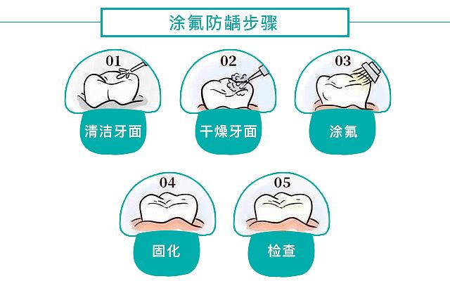 塗氟步驟