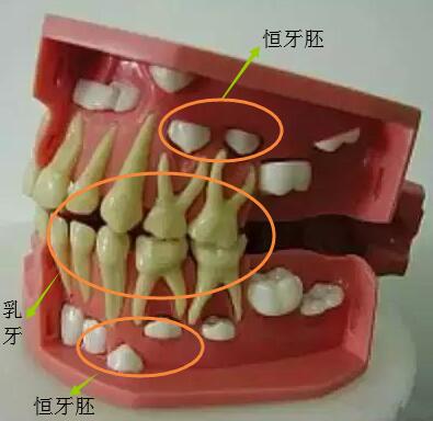 換牙時期乳牙和恒牙的關(guan) 係示意圖