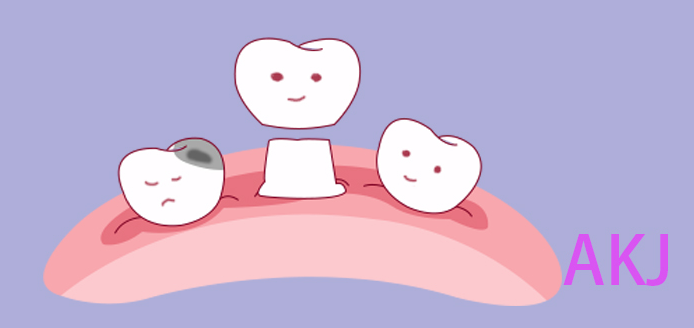 牙齒缺損做牙冠