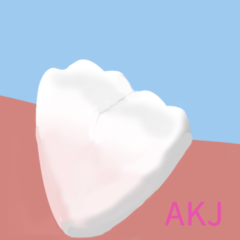 牙痛