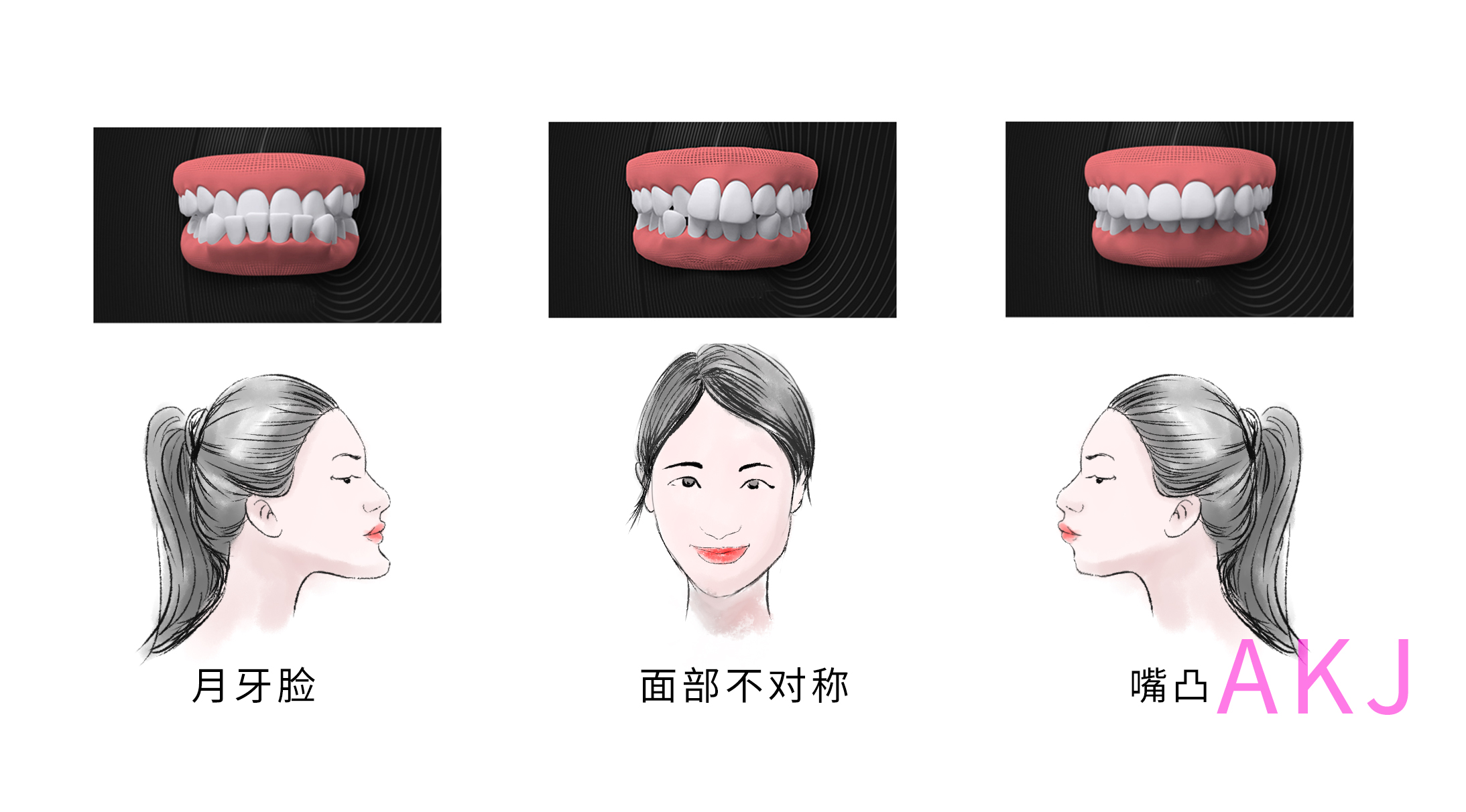 牙齒畸形