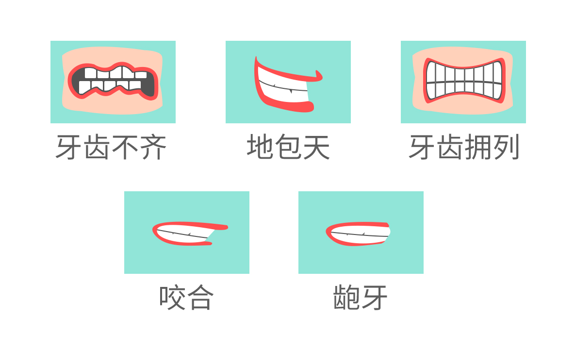 要做牙齒矯正的幾種牙齒情況