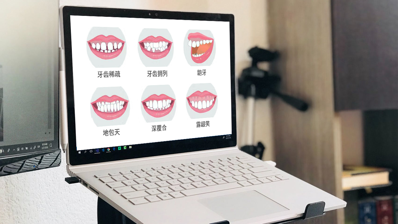 隱形正畸方法有幾種