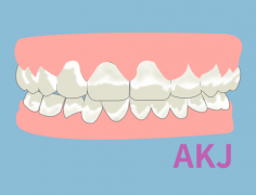 氟斑牙的發生最常見於什麽人身上？怎麽自己改善