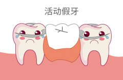 活動假牙好不好？活動假牙患者須知