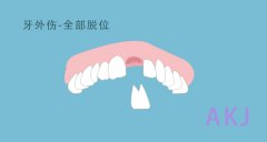 牙齒斷了怎麽辦？及時處理還有救！