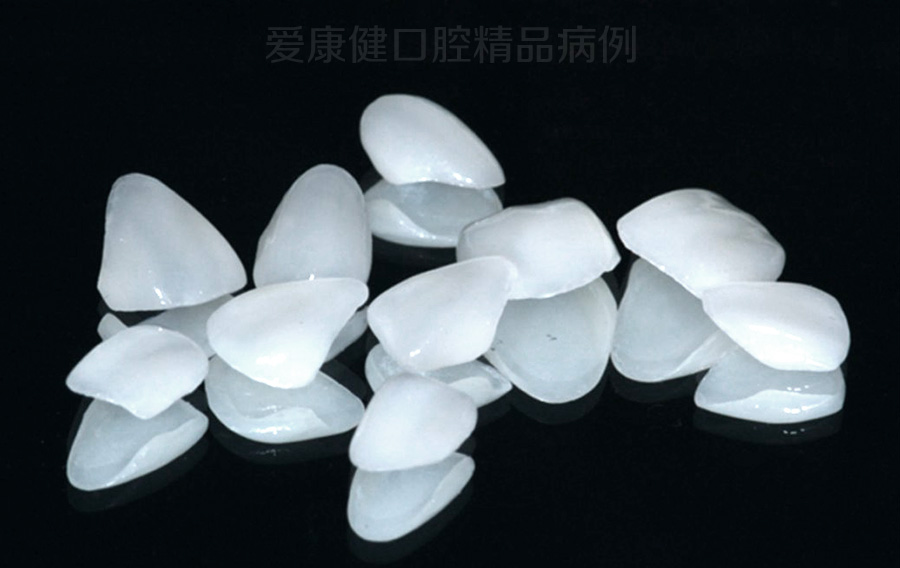 貼麵材料