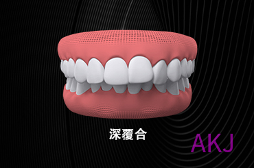 深覆蓋
