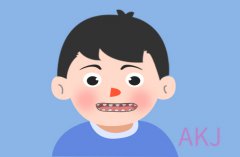 牙縫大需要戴牙套收縫牙縫嗎？深圳希瑪愛康健牙套多少錢？