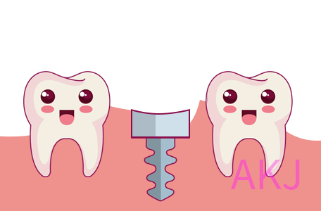  種植牙咀嚼力恢複可達95%