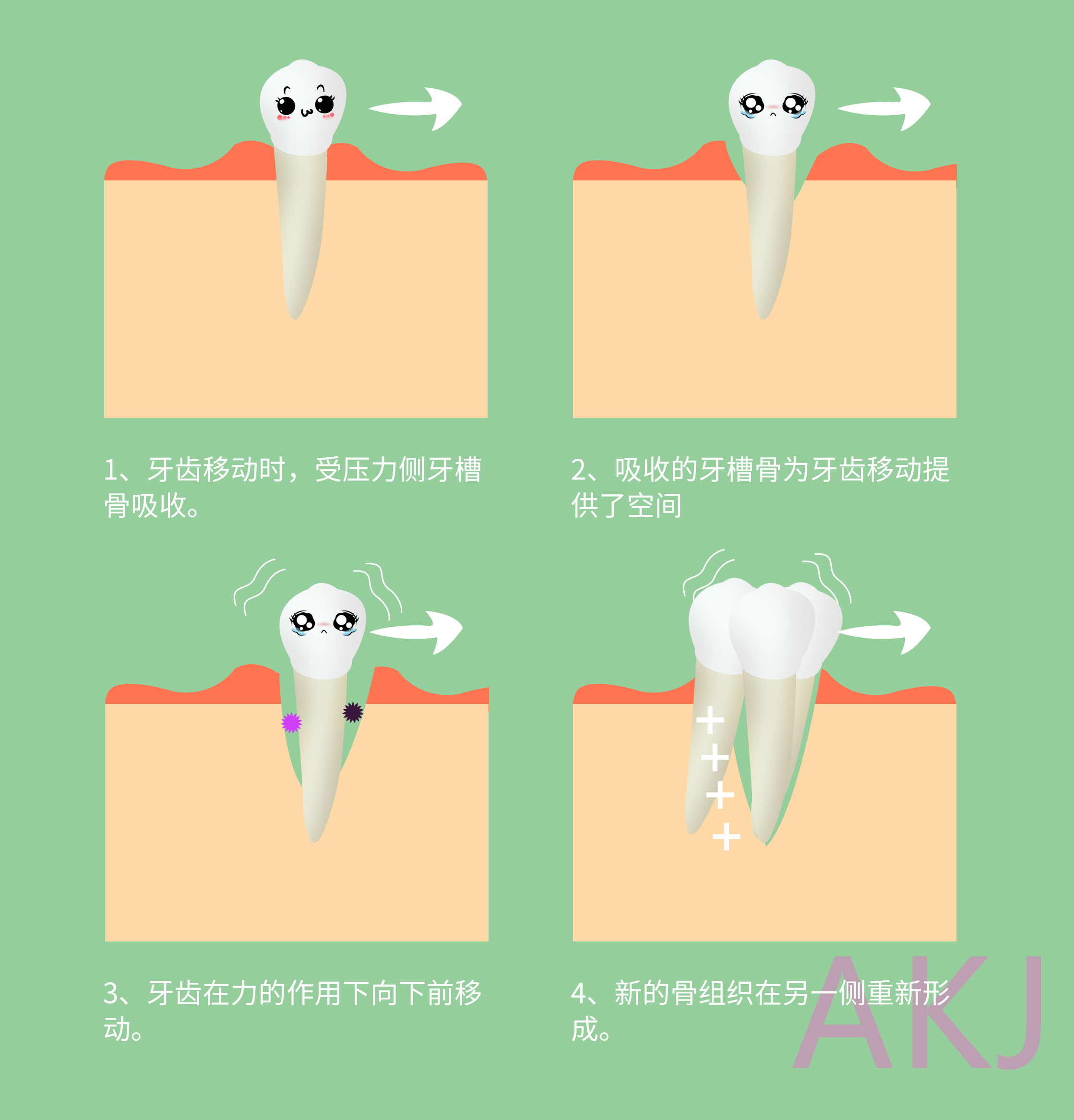 戴牙套牙齒矯正移動過程