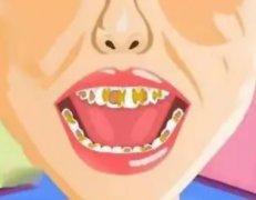 四環素牙對口腔有什麽影響？有哪些改善方法？