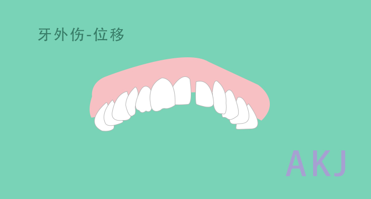 牙齒位移