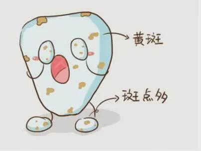煙漬牙