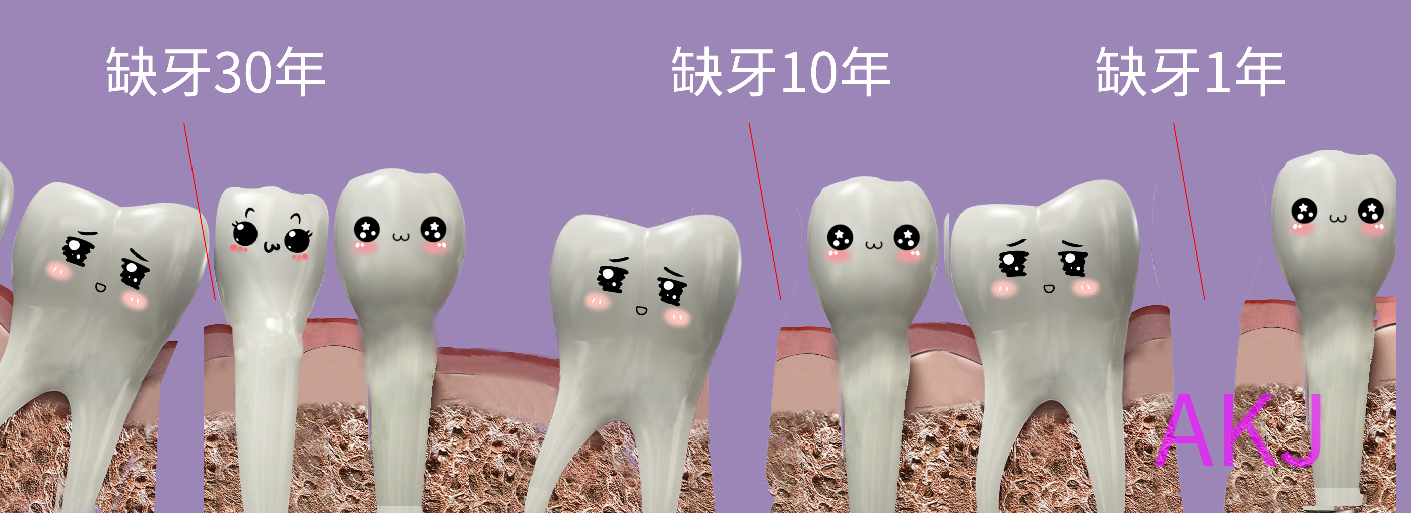 缺牙
