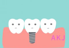 愛康健口腔醫院|後牙種植好還是鑲牙好？