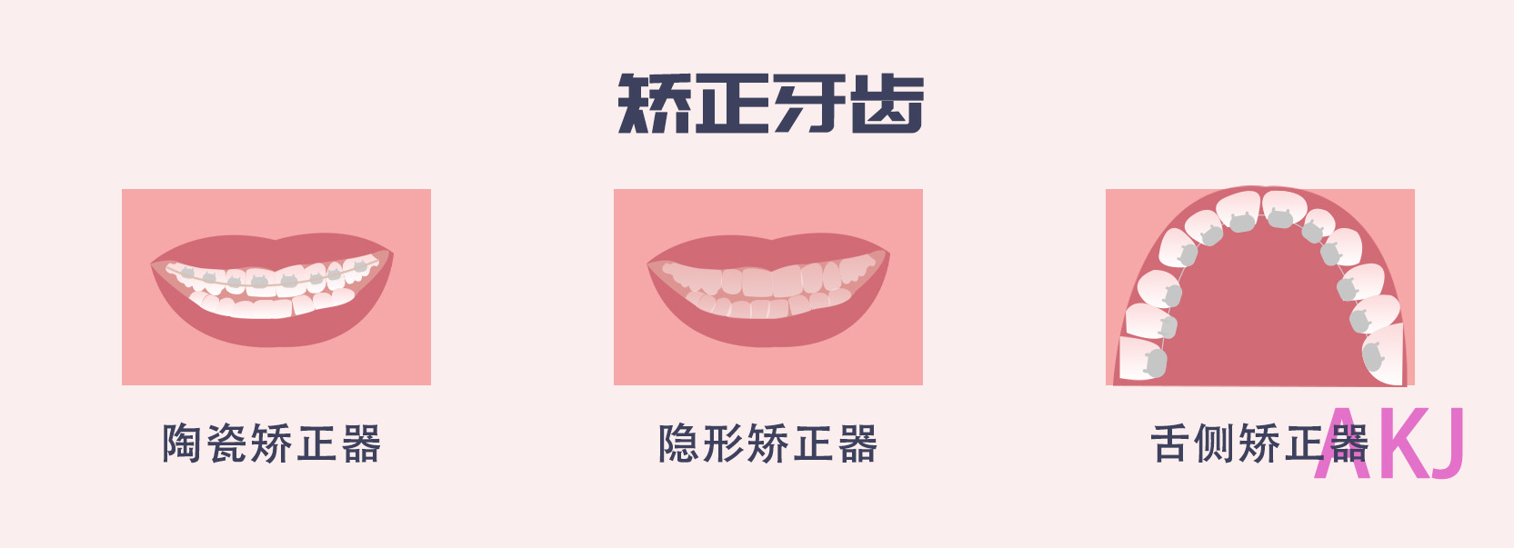 牙齒矯正