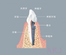 羅湖富康門診的種植牙流程是怎樣的？如何預約掛號並就診？