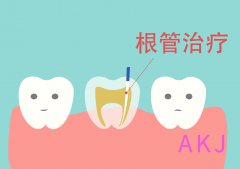 龍華牙科雅健門診解答：根管治療疼嗎？過程是怎樣的？