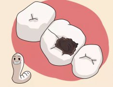 愛康健口腔醫院解析：兒童蛀牙補牙會影響恒牙生長？真的嗎？