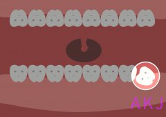 福田牙科李川門診：智齒拔牙需要注意哪些事項？