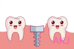 在愛康健口腔做即刻種植牙，整個過程需要多長時間？