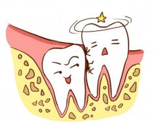 深圳智齒冠周炎治療哪裏好？羅湖愛康健口腔值得信賴